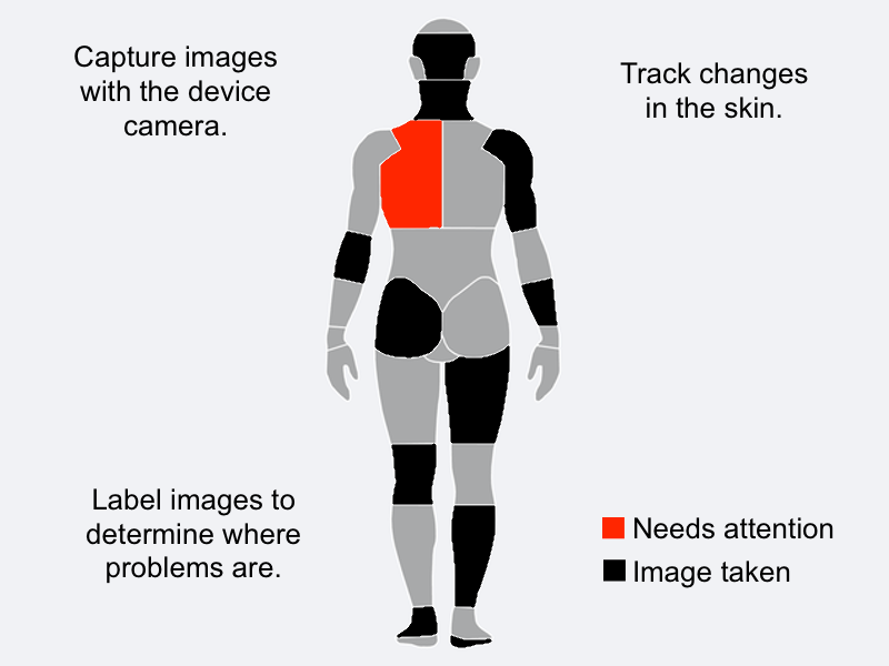 A user pinpointing a mole on the interactive body map for tracking